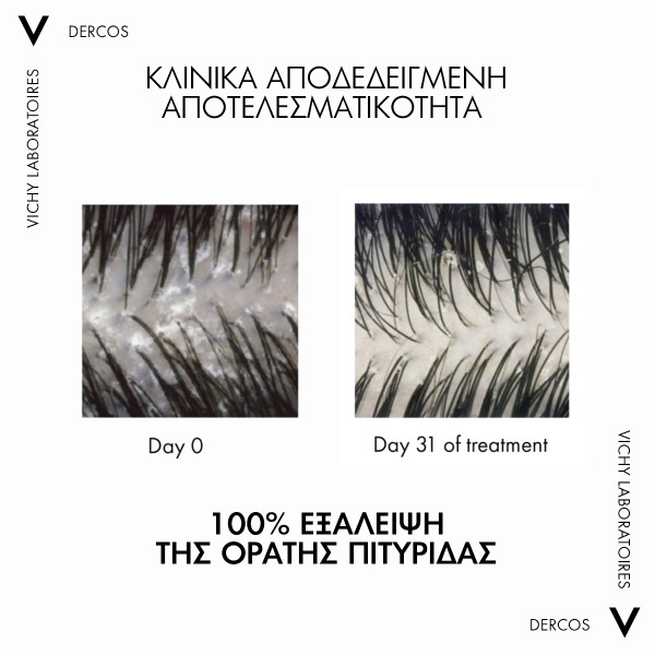 VICHY - DERCOS Anti-Dandruff DS 2in1 Dermatological Conditioning Shampoo - 200ml